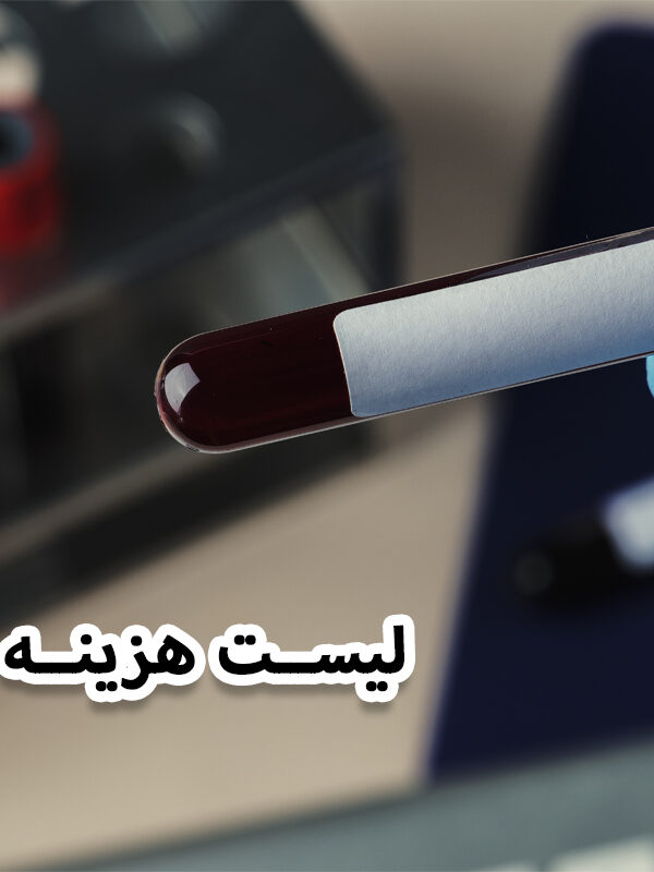 هزینه آزمایش تیرویید