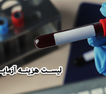 هزینه آزمایش تیرویید