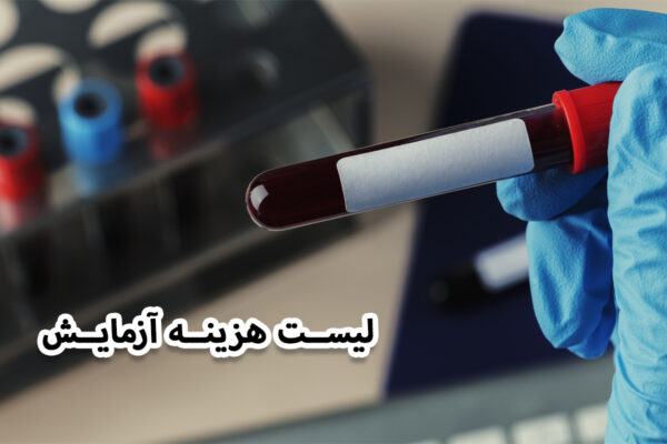 هزینه آزمایش تیرویید